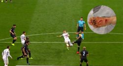 Champions, Herrera rimedia 17 punti di sutura dopo un fallo di Lichtsteiner