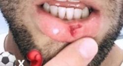 Lazio, nervi tesi in ritiro: brutta rissa tra Felipe Anderson e Hoedt [FOTO]